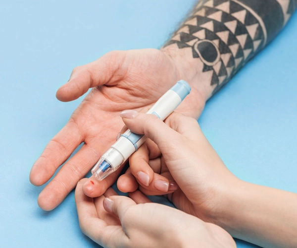 Moderne Therapien – mehr Freiheit im Alltag: Nahaufnahme einer Fingerbeere, in die mit einem Stechhilfegerät zur Blutzuckermessung gepikst wird – zeigt eine Diabeteskontrolle bei einer tätowierten Person.