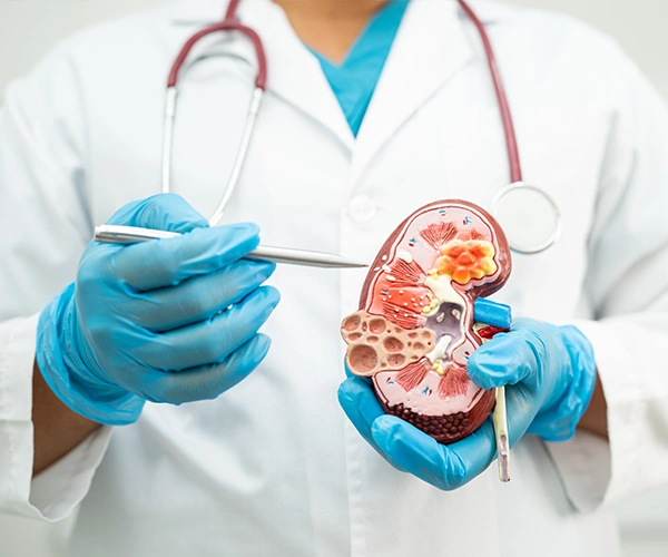 Nephrologe mit blauen Handschuhen hält ein anatomisches Modell einer Niere und erklärt mithilfe eines Instruments Nierenstrukturen und Erkrankungen.